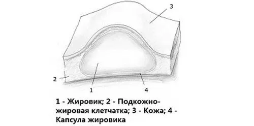 як лікувати жировики на обличчі у дитини