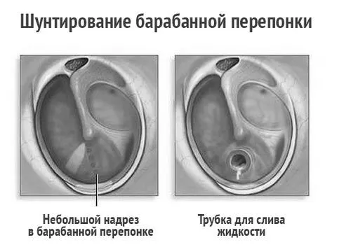лікування
