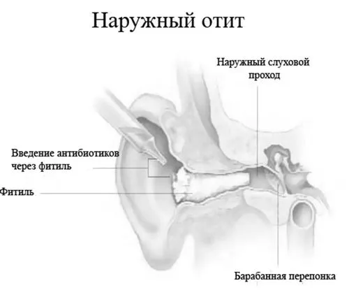види