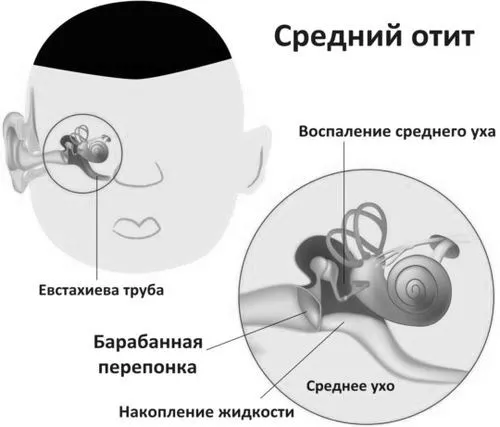 лікування