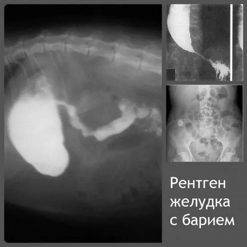 як лікувати моторику шлунку