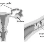вплив