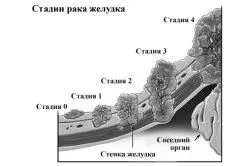 ентерологіі будинку