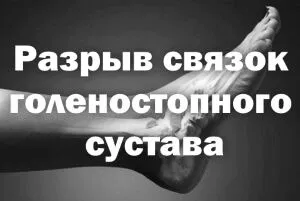 язок