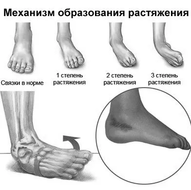 лікування