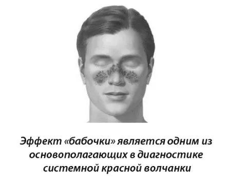 рак мову патологія симптом ознака причина захворювання профілактика дно порожнину рота фото відео хвороба захворювання