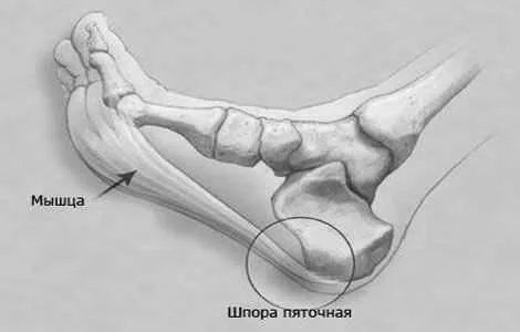 умовах