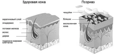 частини