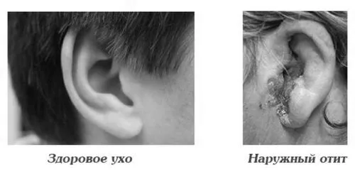 дорослих