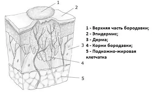 появи