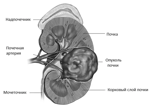 симптоми