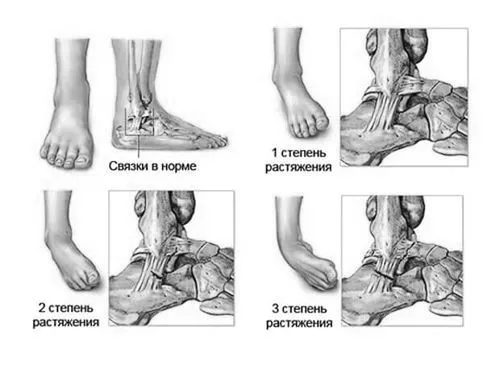 язок