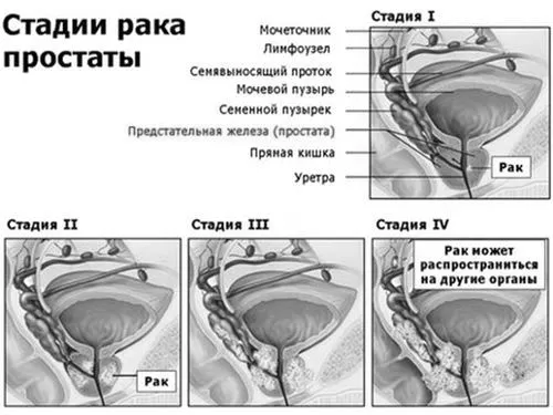 залози