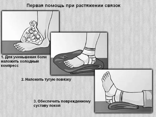 як лікувати частковий розрив зв'язок