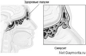 симптоми