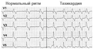 причини