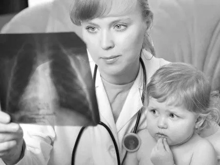 Сегментарна пневмонія: причини, симптоми і лікування у дорослих і дітей пневмонія