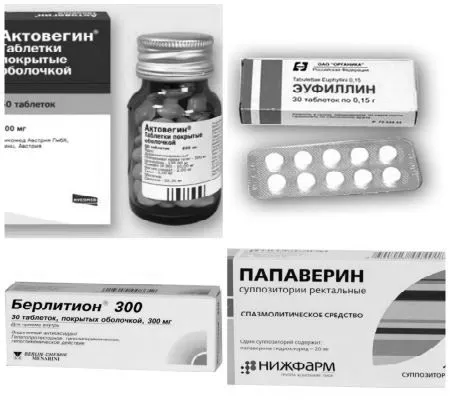 остеохондрозі