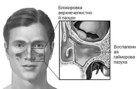 симптоми