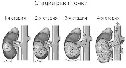 раку