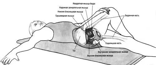 синдром