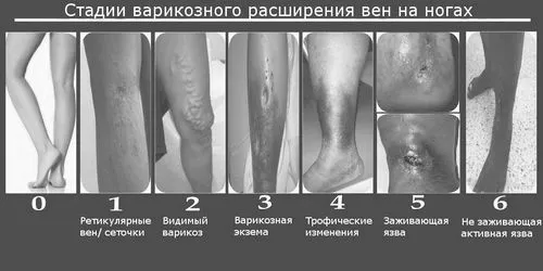 ступеня
