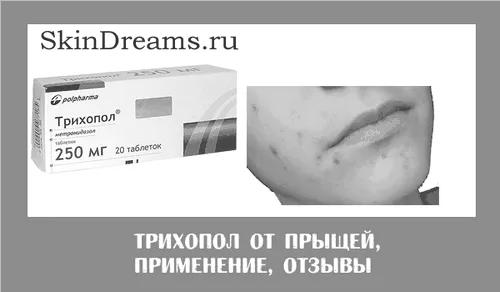 відгуки