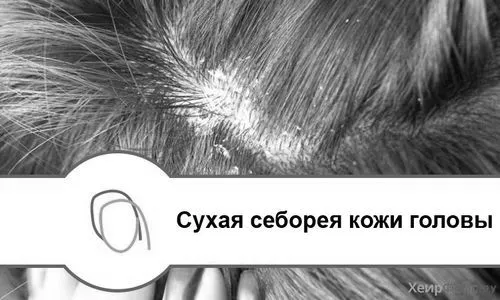 шкіри
