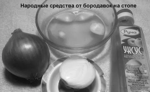 Видалення бородавок в домашніх умовах аптечними або народними засобами підошовні бородавки як позбутися в домашніх умовах