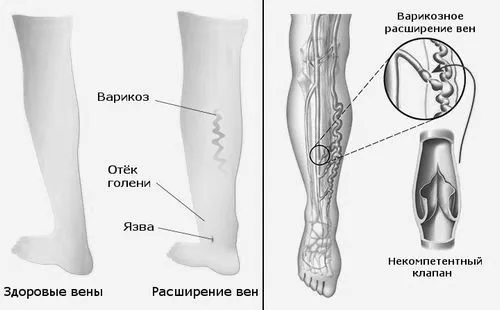 кров