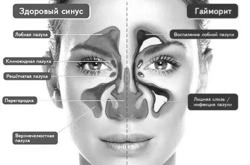 причини