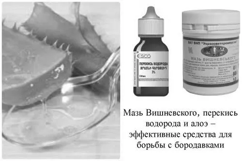Видалення бородавок в домашніх умовах аптечними або народними засобами підошовна бородавка лікування в домашніх умовах