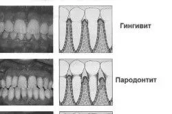 запалилася