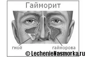 лікування