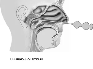 лікування