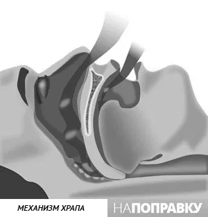 причини хропіння