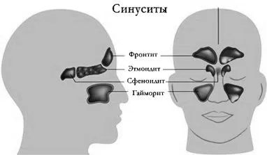 симптоми