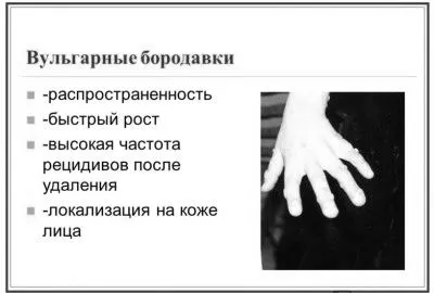 бородавки
