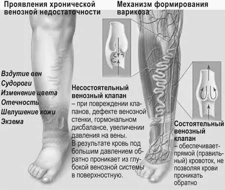 розширення