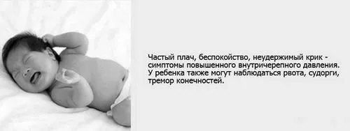 Внутрішньочерепний тиск у немовлят - симптоми, ознаки та лікування симптоми