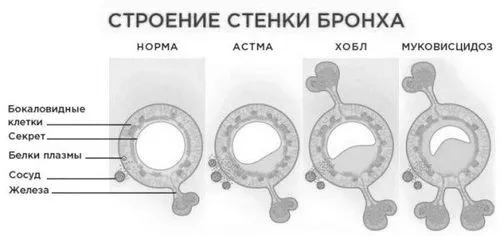 відхаркувальний
