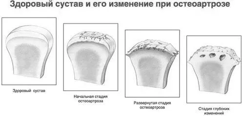 ноги