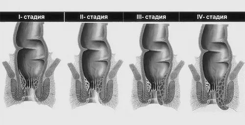 лікування