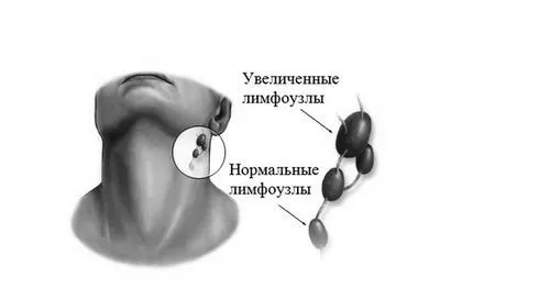 шишка за вухом фото
