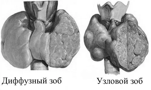 щитовидної