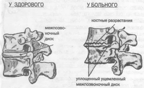 хребта
