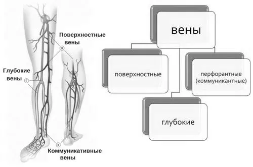 варикоз