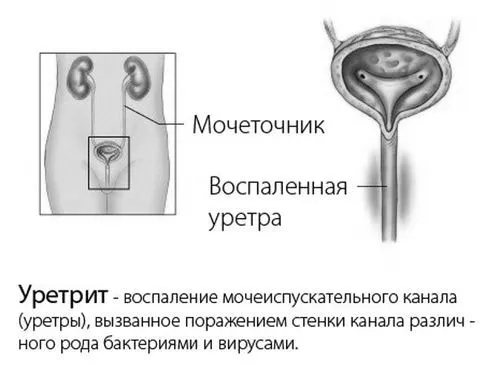 чоловіків
