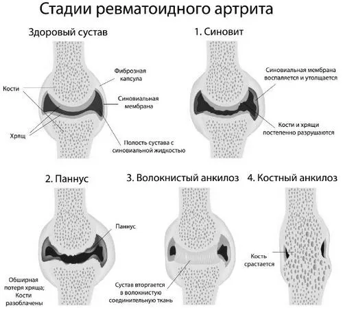 ноги