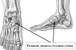 суглобі